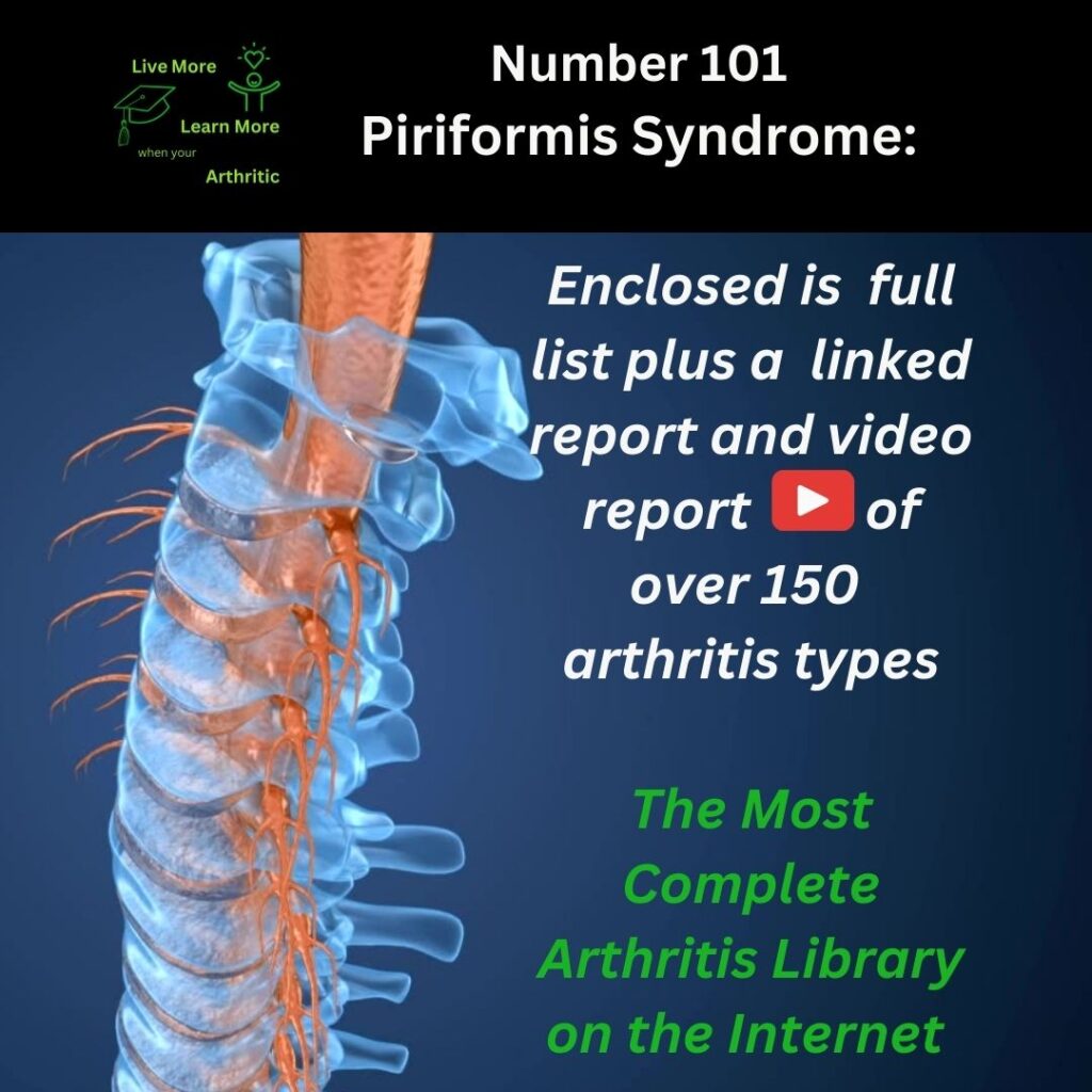 Piriformis Syndrome Number 101 of around 150 types of Arthritis
